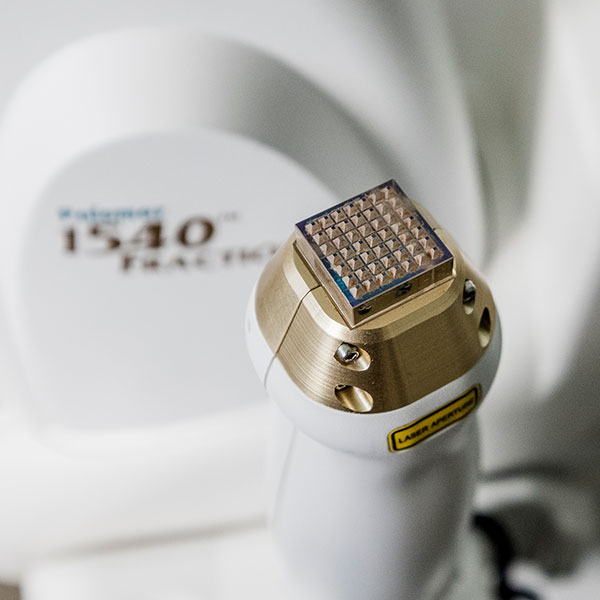 NOLEGGIO-APPARECCHI-LASER